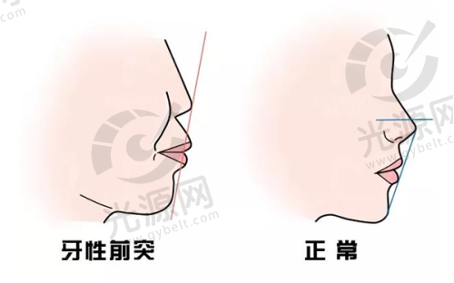 二、德尔美客整形医院的项目技术优势