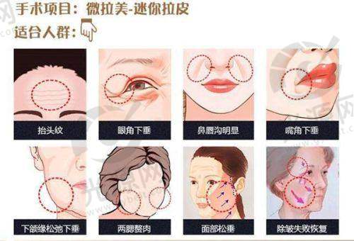 一、南通伊莱美整形医院——专精认证、高端设备与服务