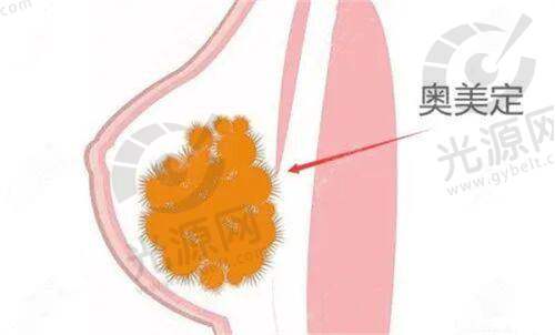 开封市誉美医疗美容整形医院口碑与实力分析，值得信赖的正规医美机构选择指南