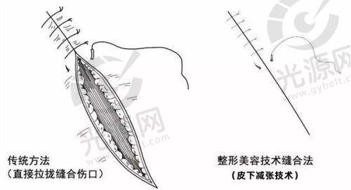 新疆有没有牛逼的整形医生排名第四:张伟医生