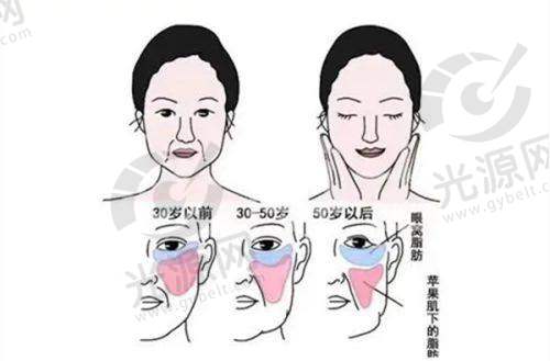 额头缩小手术的价格如何？