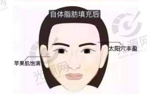 替迪医生的变性手术成效：技术优势与特点