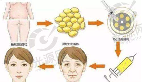 五、洛阳爱尚整形医院预约挂号攻略