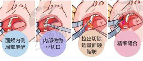 五、君熠医疗美容医生预约挂号攻略