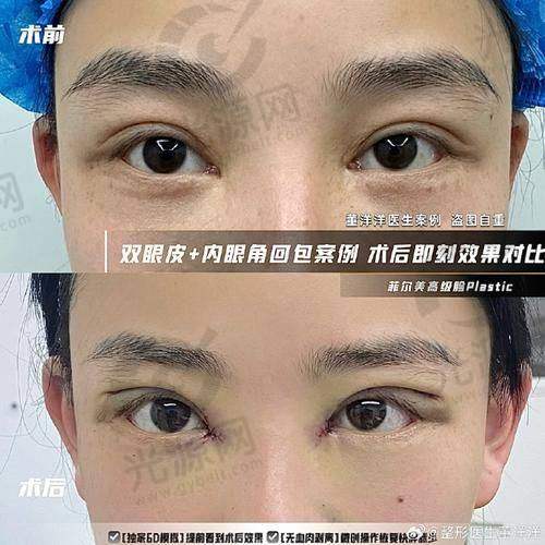 华美比较出名眼部医生排名第四：张敏珠医生