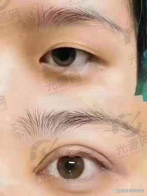 三、眼综合国内好的医生价格表