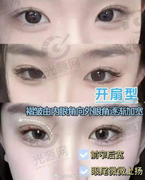 四、深圳割双眼皮医生排名口碑评价