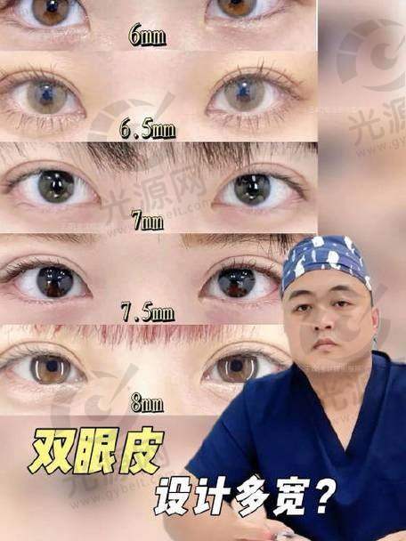二、沈阳个双眼皮好的医生详细介绍