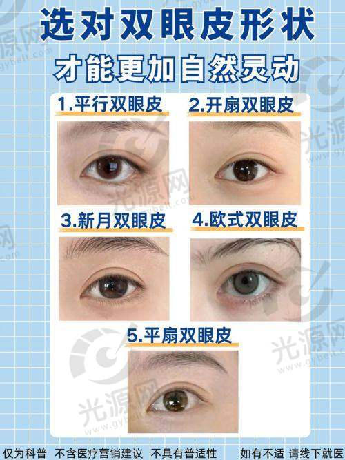 沈阳做双眼皮好的医生有谁？沈阳双眼皮专家推荐：张莹莹、杜继凤等医生手术效果解析与选择指南