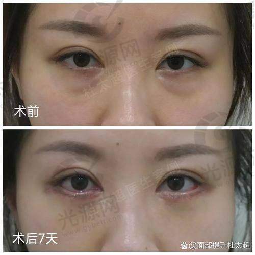 三、重庆锦美整形医院口碑如何：分享几位顾客的真实实例