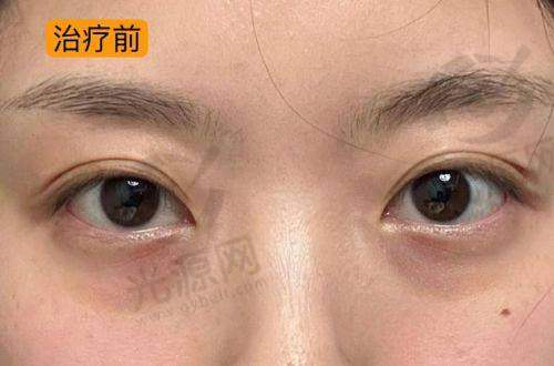总结