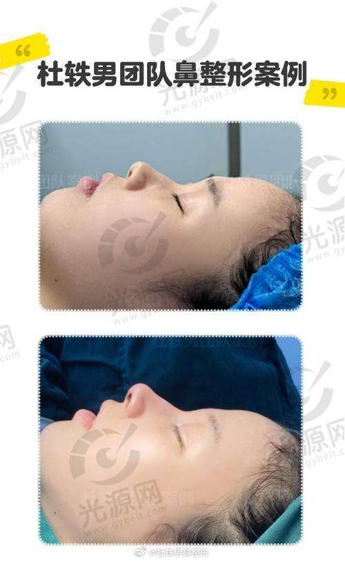 结语：挛缩控制，关乎健康与美丽