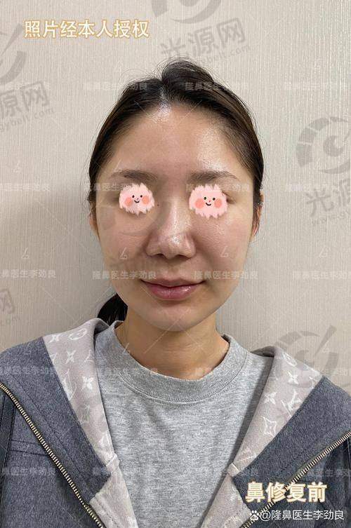 王英勇实例：真实口碑与成效展示