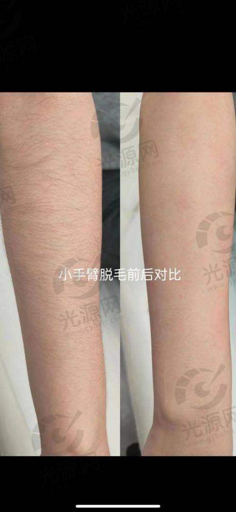 二、达州整形医院脱毛每家医院的详细介绍