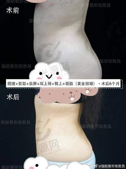 一、赤峰哪个医院减肥吸脂比较好榜单前十名单