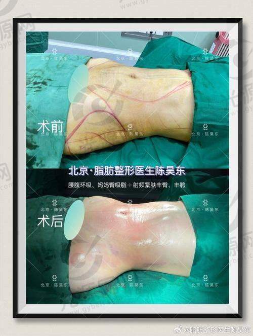 5. 赤峰悦美医疗美容医院 - 专注女性塑形需求