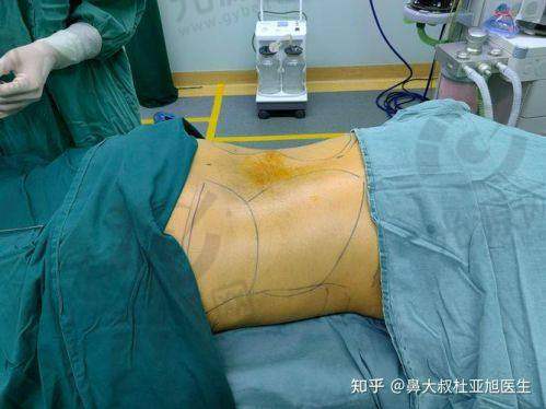 二、赤峰哪个医院减肥吸脂比较好每家医院的详细介绍