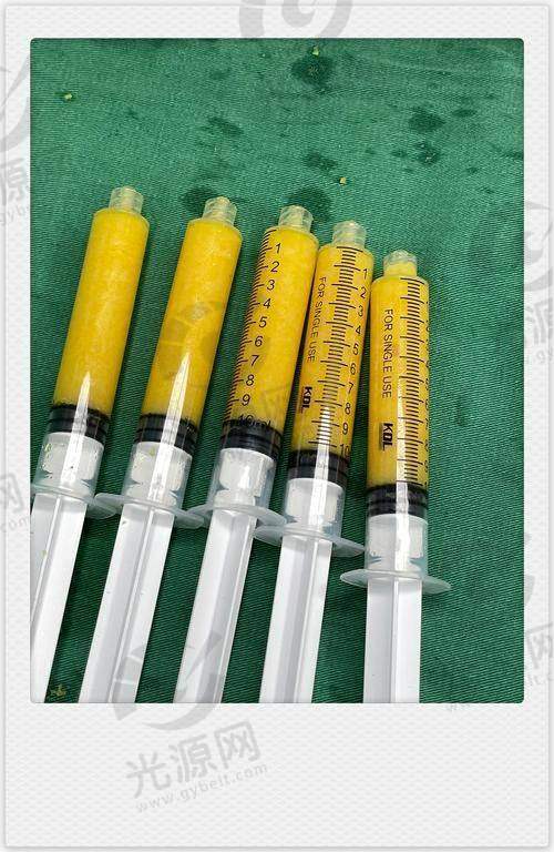 1. 赤峰锦然整形 - 专精吸脂与皮肤紧致技术结合