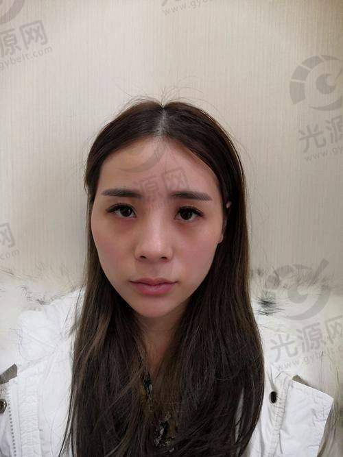一、西安自体脂肪填充医院排名前十