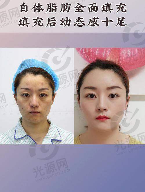 10. 西安华美医疗美容医院 - 大型医疗美容连锁