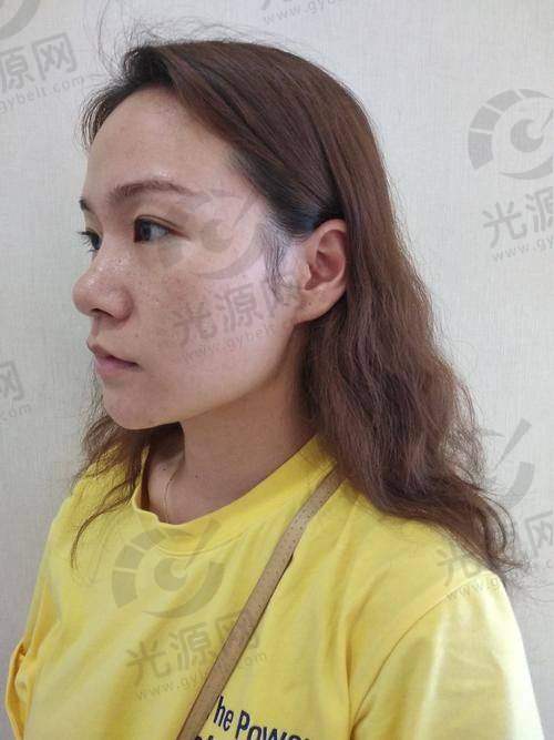 4. 西安画美医疗美容医院 - 专注个性化定制