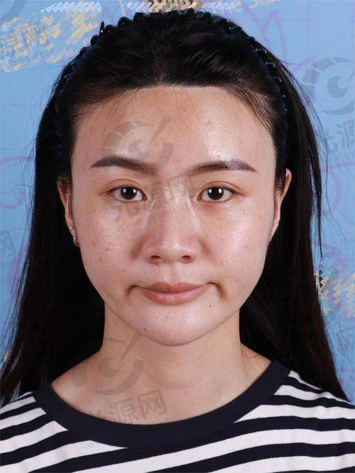 9. 西安爱思特医疗美容医院 - 重视患者体验