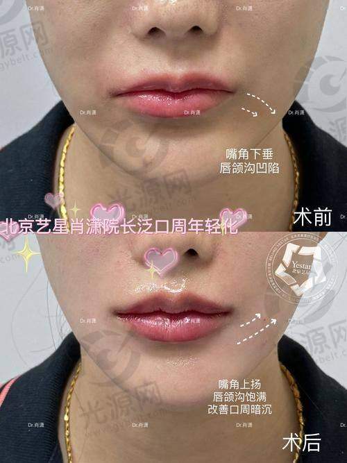 成都医 大李辉做唇怎么样？