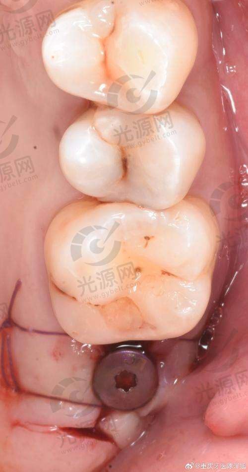 三、珠海拜博口腔医院口碑分享