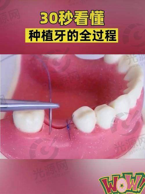 2. 银川艾齿口腔医院——数字化技术引领口腔现潮流