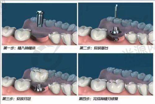 8. 银川品悦口腔医院——温馨舒适的就医环境