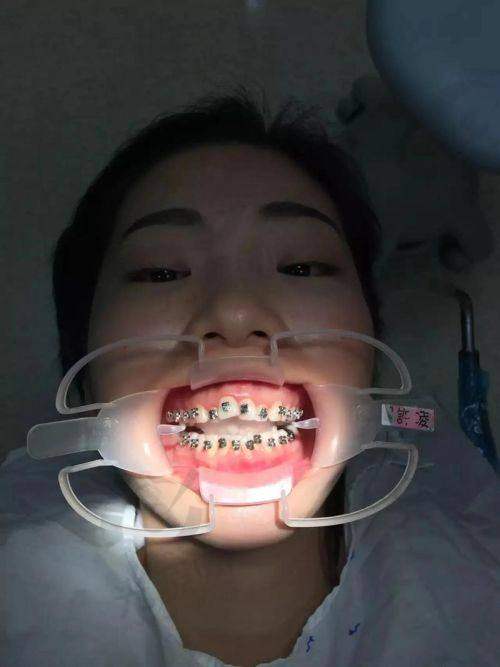 淮安牙科医生做矫正排名第1：张医生