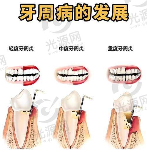 患者个人成功实例分享