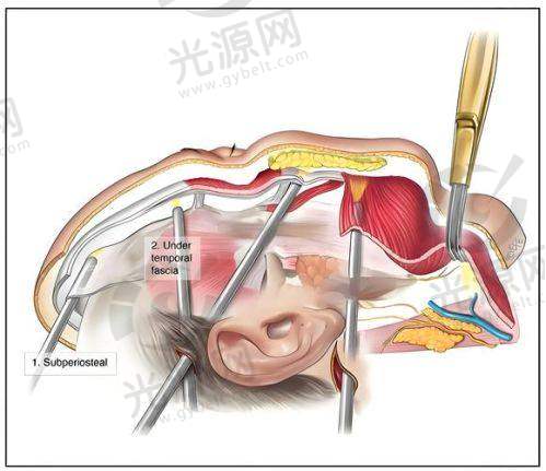 聂云飞医生在抗衰老领域的口碑评价