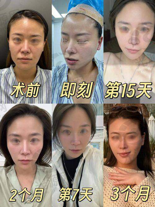 聂云飞医生所在医院及预约方式