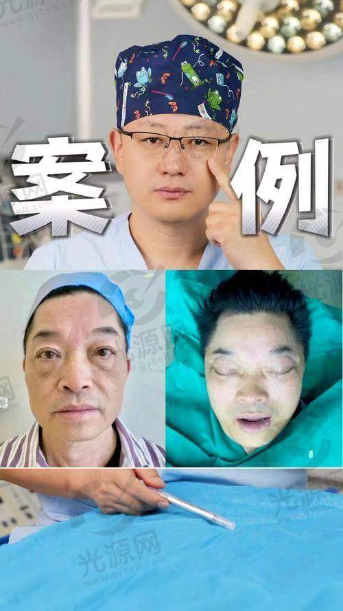 聂云飞医生的手术费用与适合人群