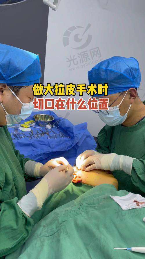 总结：选择聂云飞医生，重拾青春光彩