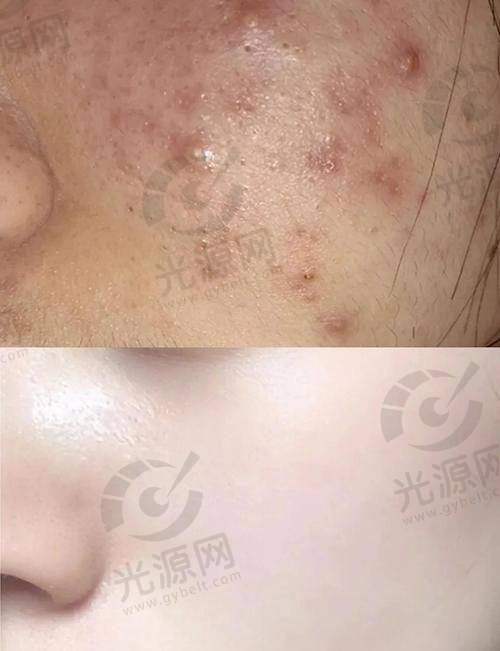 三、海南省人民医院皮肤科的患者评价与成功实例分享