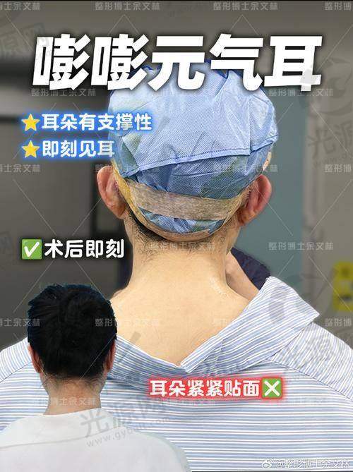 三、湘雅医院耳朵整形医生的真实实例分享