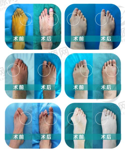 马桂文医生的手术费用——透明合理的收费标准