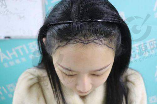 一、徐州新生毛发医院的详细介绍