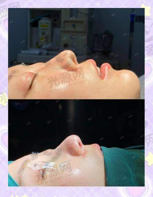 个体因素对挛缩控制的影响