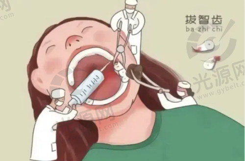 宁愿拔牙不做根管治疗的患者心理