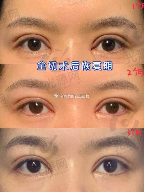 张召医生资质怎么样？患者口碑如何？