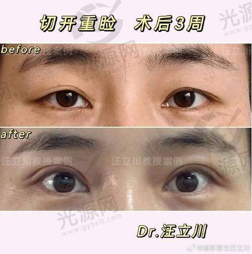 如何预约张召医生的挂号？