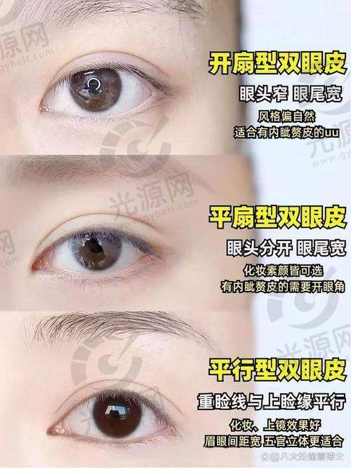 ME双眼皮手术的不足之处