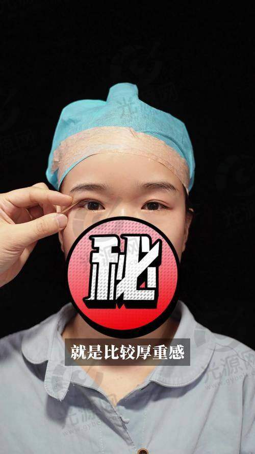 一、广州做双眼皮比较好的医生十大榜单