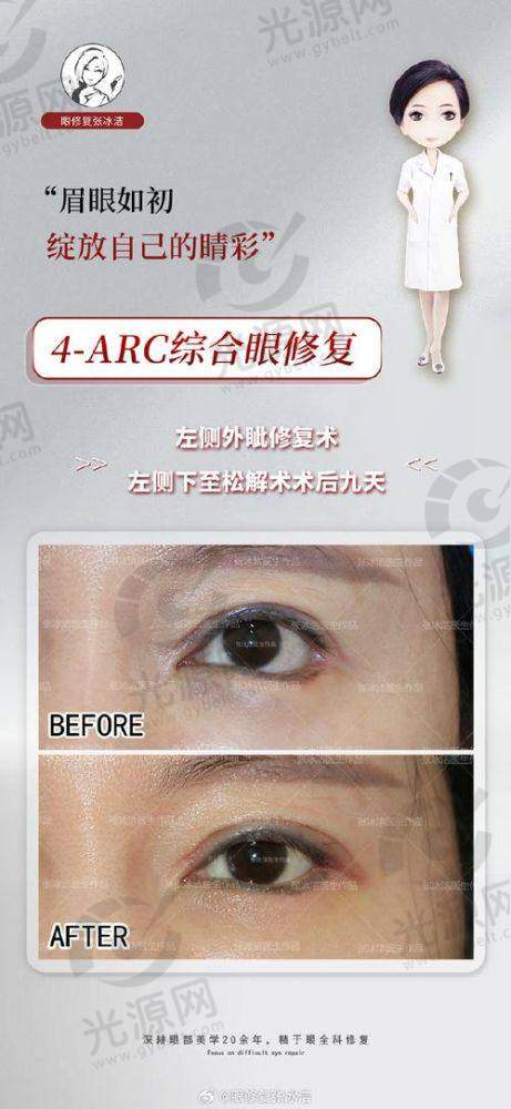 总结