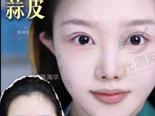 三、苏州市常春藤医疗美容医院的求美者评价与实例分享