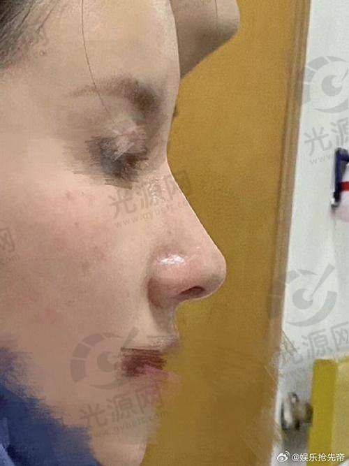 长春做鼻子好的医生详细介绍