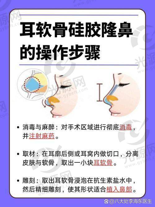 昆明做鼻子有名的医生排名第9：王继华医生